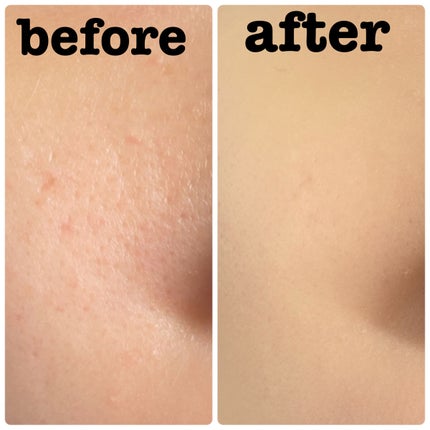 (旧)アンリミテッド ラスティング フルイド/shu uemura/リキッドファンデーションを使ったクチコミ(5枚目)