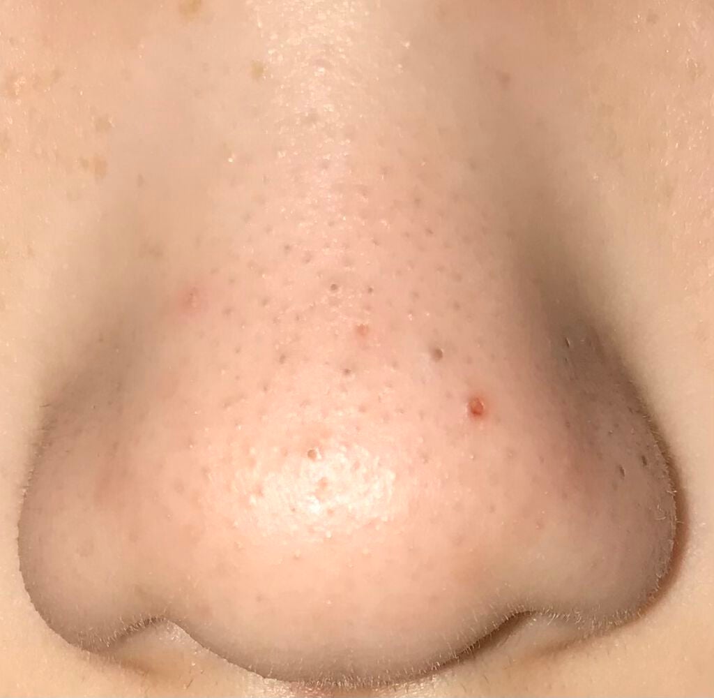 ホホバオイル/無印良品/ボディオイルを使ったクチコミ(1枚目)