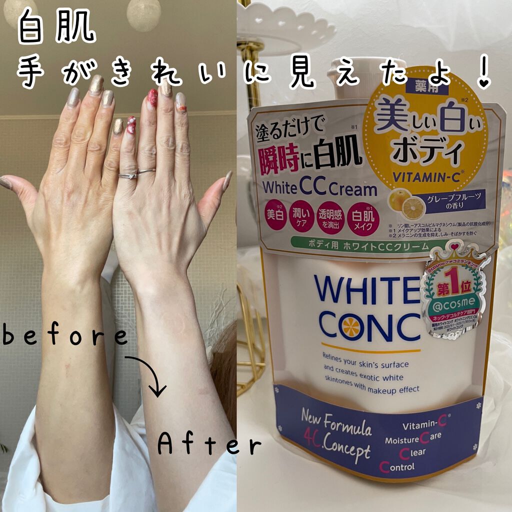 薬用ホワイトコンク ホワイトニングCC CII/ホワイトコンク/ボディクリームを使ったクチコミ(1枚目)