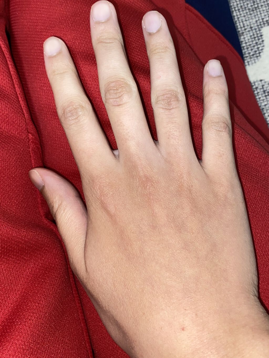 光脱毛器 VIO/Sarlisi/家庭用脱毛器を使ったクチコミ（2枚目）