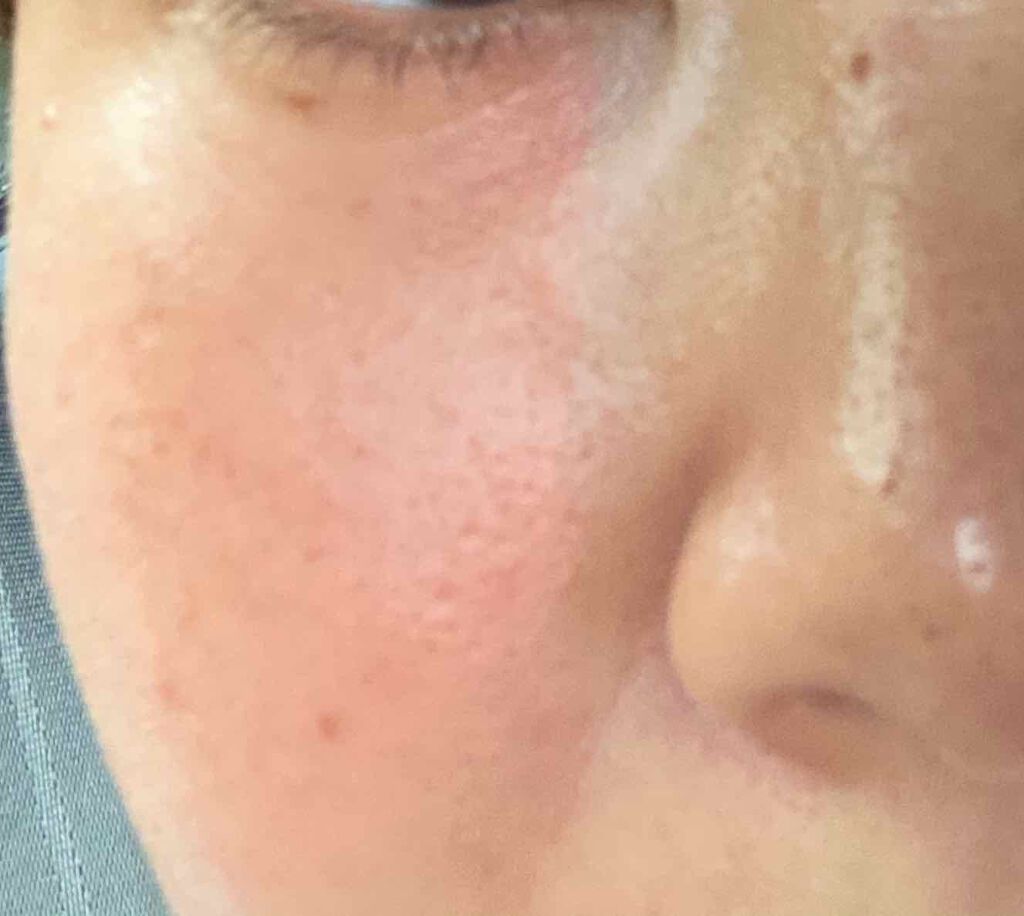 ハトムギ化粧水(ナチュリエ スキンコンディショナー R )/ナチュリエ/化粧水を使ったクチコミ(2枚目)