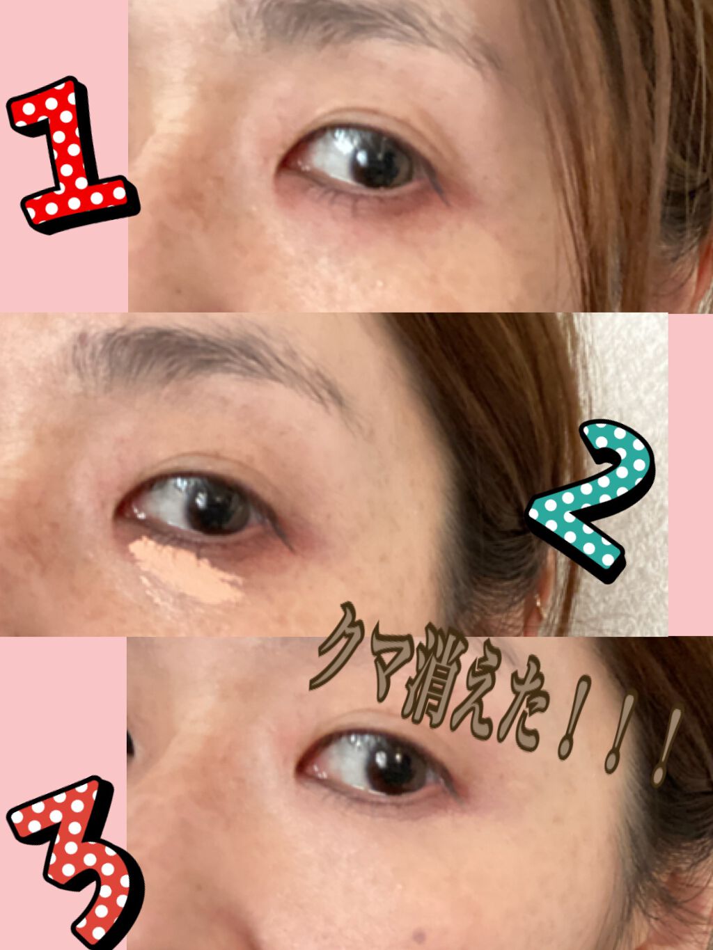 ストレッチコンシーラー/CEZANNE/リキッドコンシーラーを使ったクチコミ（3枚目）