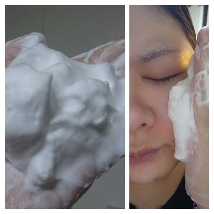 パーフェクトホイップ アクネケア/SENKA(専科)/洗顔フォームを使ったクチコミ(4枚目)