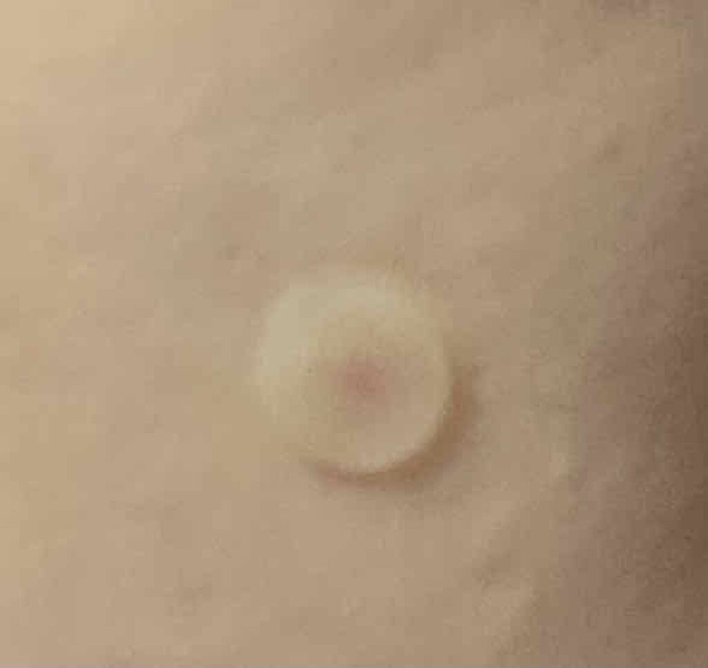 SKINCOVER PATCH（スキンカバー パッチ）/SKINCOVER PATCH/その他を使ったクチコミ（3枚目）