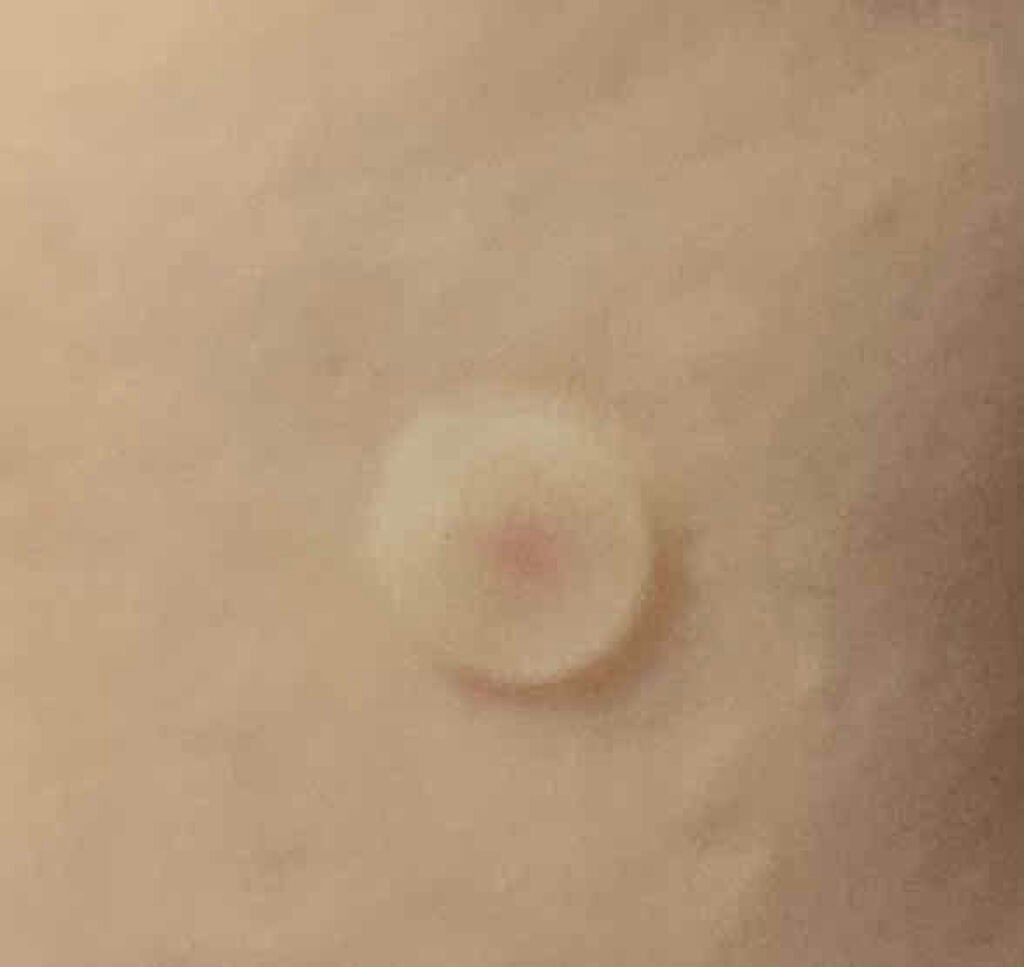 SKINCOVER PATCH(スキンカバー パッチ)/SKINCOVER PATCH/その他を使ったクチコミ(3枚目)