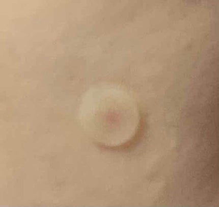 SKINCOVER PATCH(スキンカバー パッチ)/SKINCOVER PATCH/その他を使ったクチコミ(3枚目)