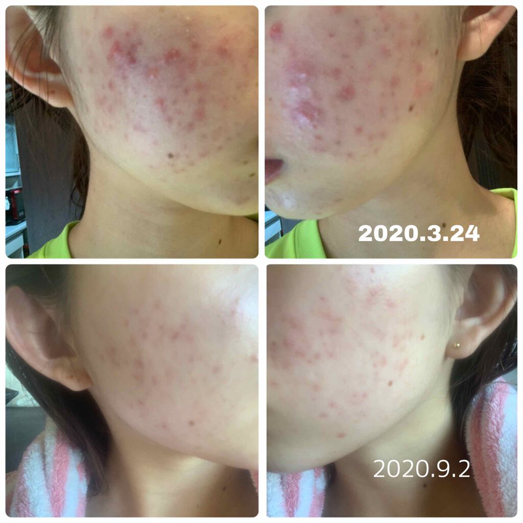 CICA デイリースージングマスク/VT/シートマスク・パックを使ったクチコミ(1枚目)