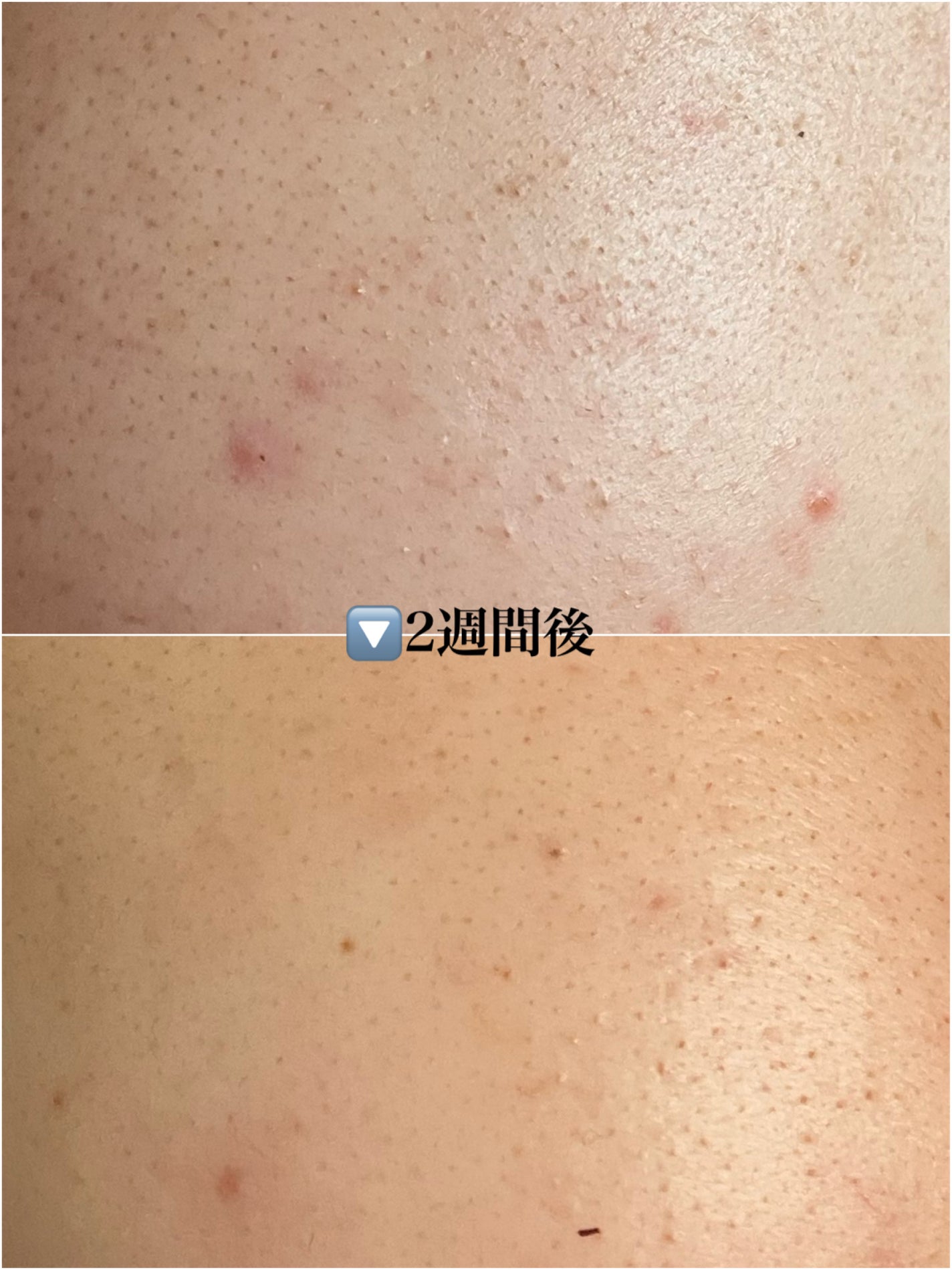 CICA デイリースージングマスク/VT/シートマスク・パックを使ったクチコミ(5枚目)