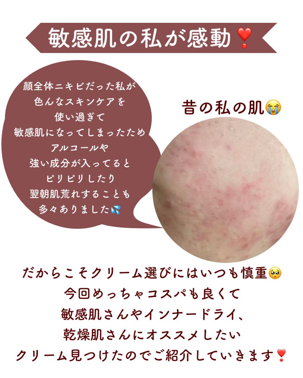 プレミアム インテンスケア クリーム/黒糖精/フェイスクリームを使ったクチコミ（2枚目）