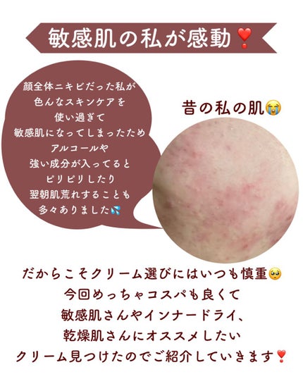 プレミアム インテンスケア クリーム/黒糖精/フェイスクリームを使ったクチコミ(2枚目)