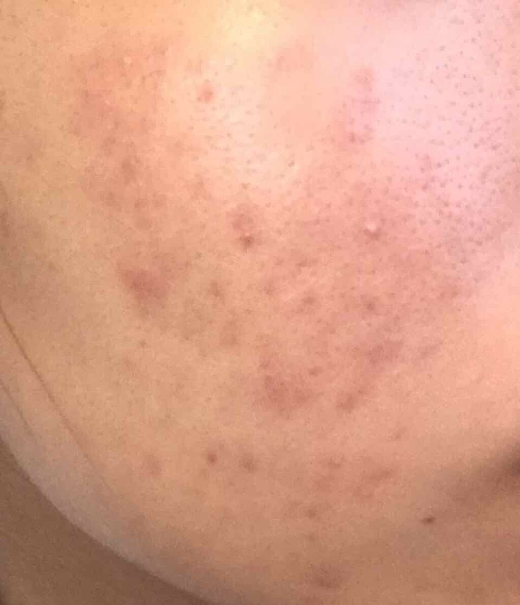 日本酒のメイク落とし/菊正宗/クレンジングジェルを使ったクチコミ（2枚目）