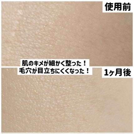 シカバイタル エッセンス/VT/美容液を使ったクチコミ(4枚目)