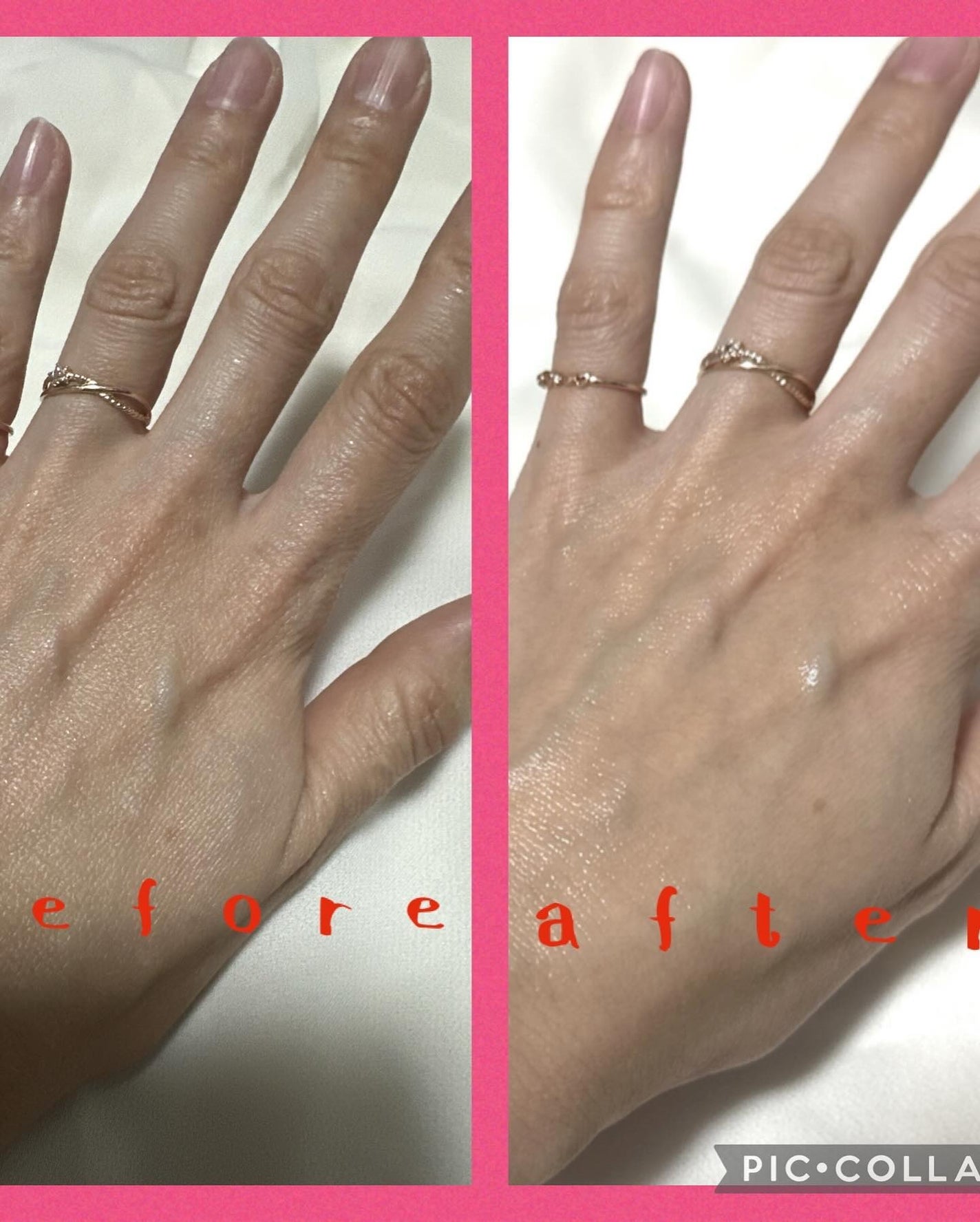 kico on LIPS ãðããªã¹åç²§åãã€ãã£ãŒã³ã³ã¯è¬çšã¯ãªã¢ããŒã·ã§ã³ðããããâŒ..ãïŒ3æç®ïŒ