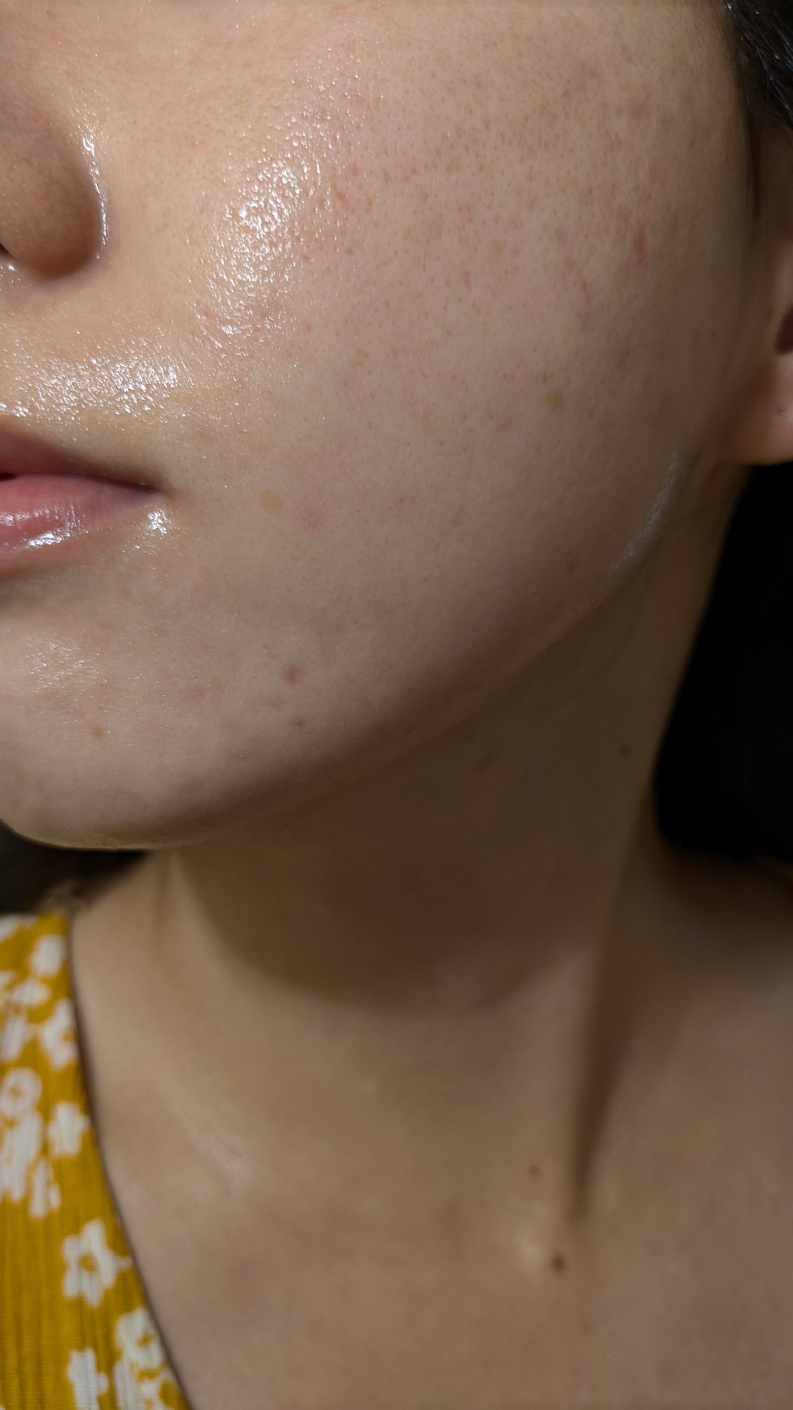 A2+NAG2ソリューション/The Ordinary/美容液を使ったクチコミ（2枚目）