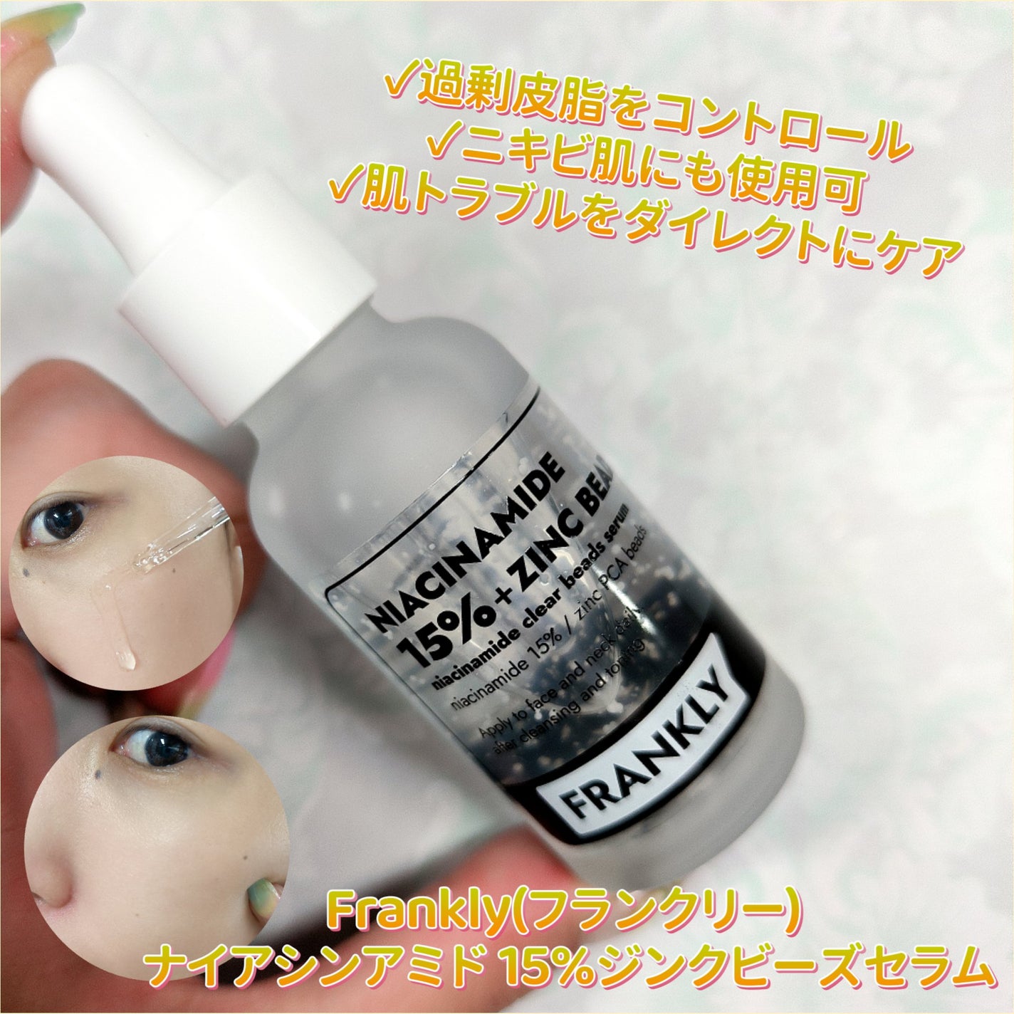 ナイアシンジンクビーズセラム/Frankly/美容液を使ったクチコミ(1枚目)