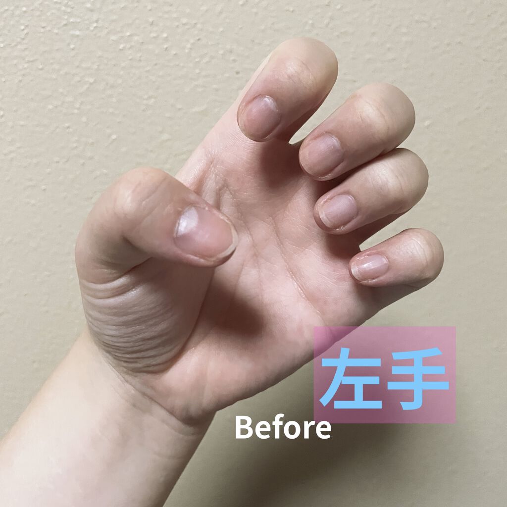 エテュセ クイックケアコート/ettusais/ネイルオイル・トリートメントを使ったクチコミ（3枚目）