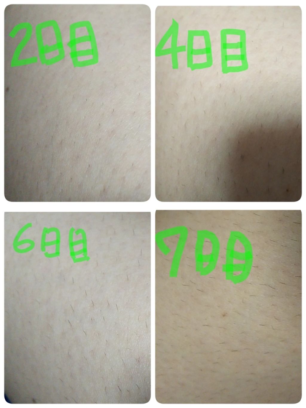 アロエスキンクリーム 100g/DAISO/フェイスクリームを使ったクチコミ(3枚目)