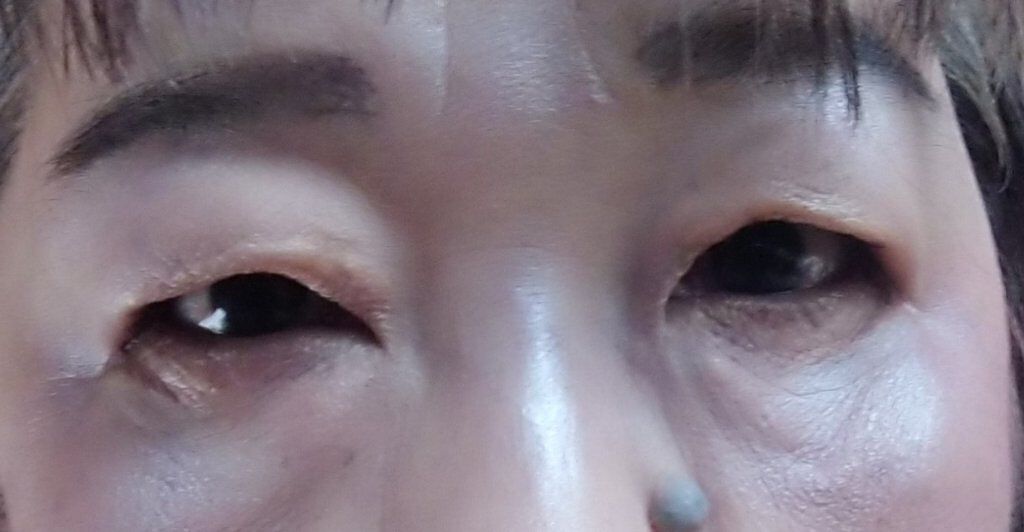 ルース パウダー/ちふれ/ルースパウダーを使ったクチコミ（2枚目）