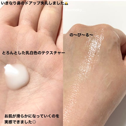 エンリッチCセラム/IGA LAB/美容液を使ったクチコミ(3枚目)