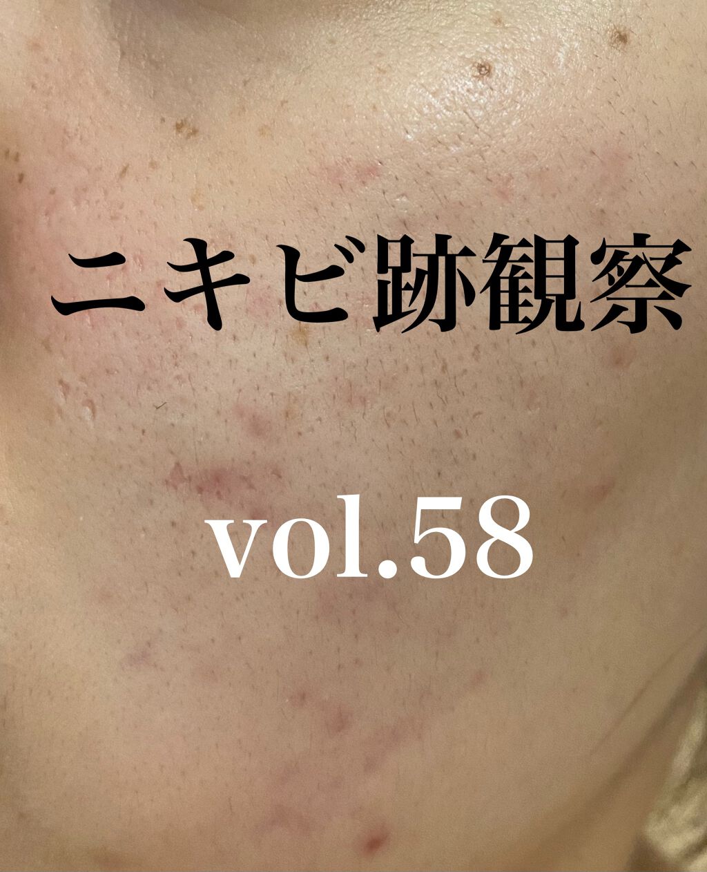 潤浸保湿 フェイスクリーム/キュレル/フェイスクリームを使ったクチコミ（1枚目）