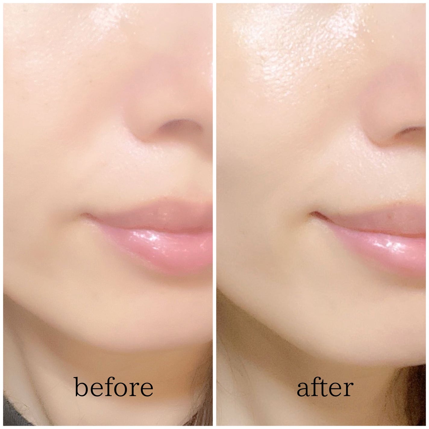 PDRNピンクアンプル PDRN 10,000ppm配合/MEDICUBE/美容液を使ったクチコミ(6枚目)