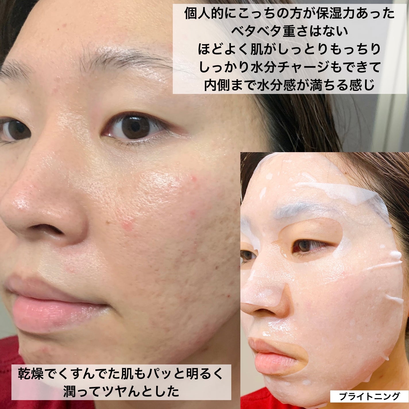 モーメント フォー スキンマスク/innisfree/シートマスク・パックを使ったクチコミ(9枚目)