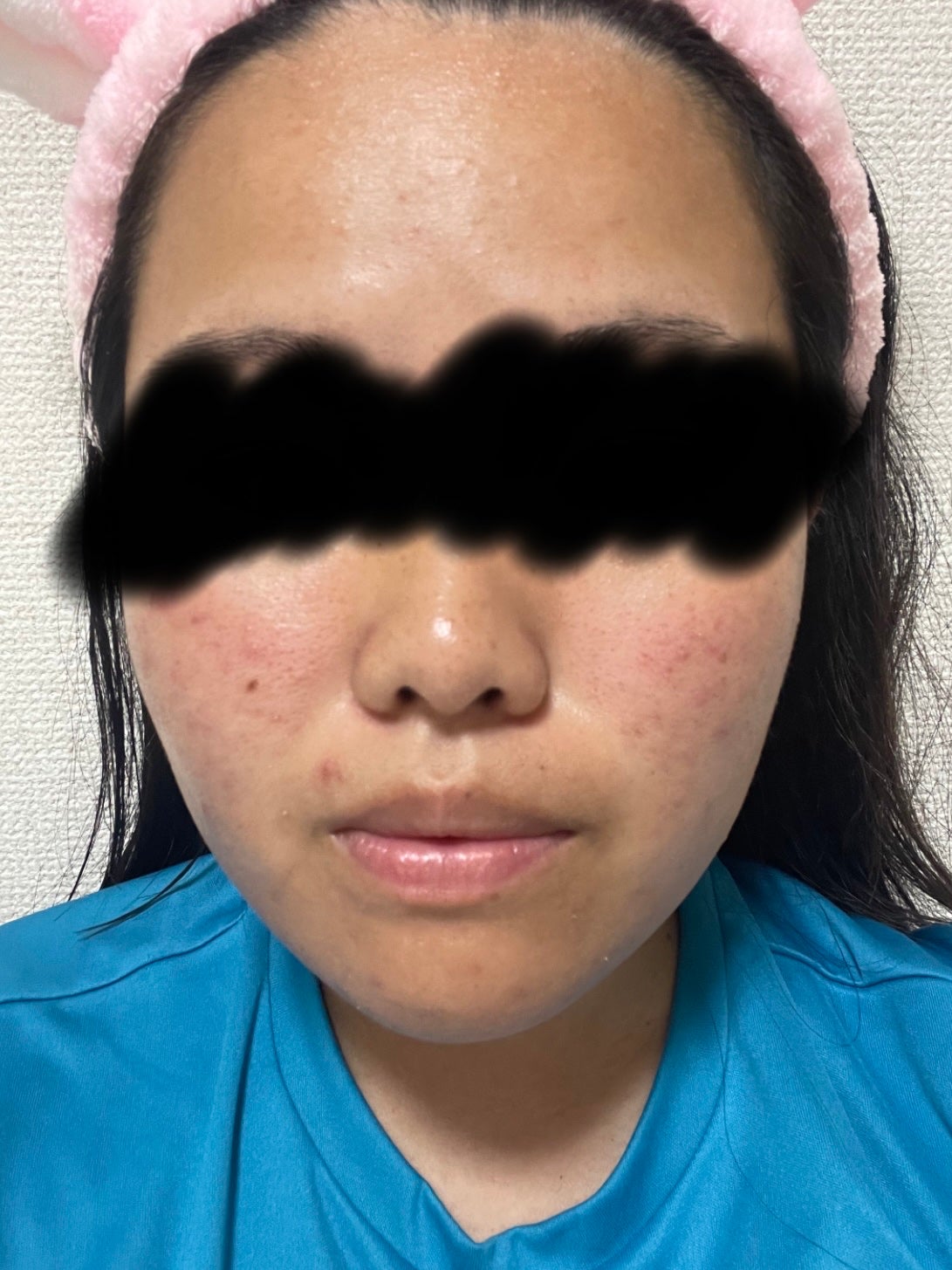 薬用 極潤 スキンコンディショナー/肌ラボ/化粧水を使ったクチコミ(2枚目)