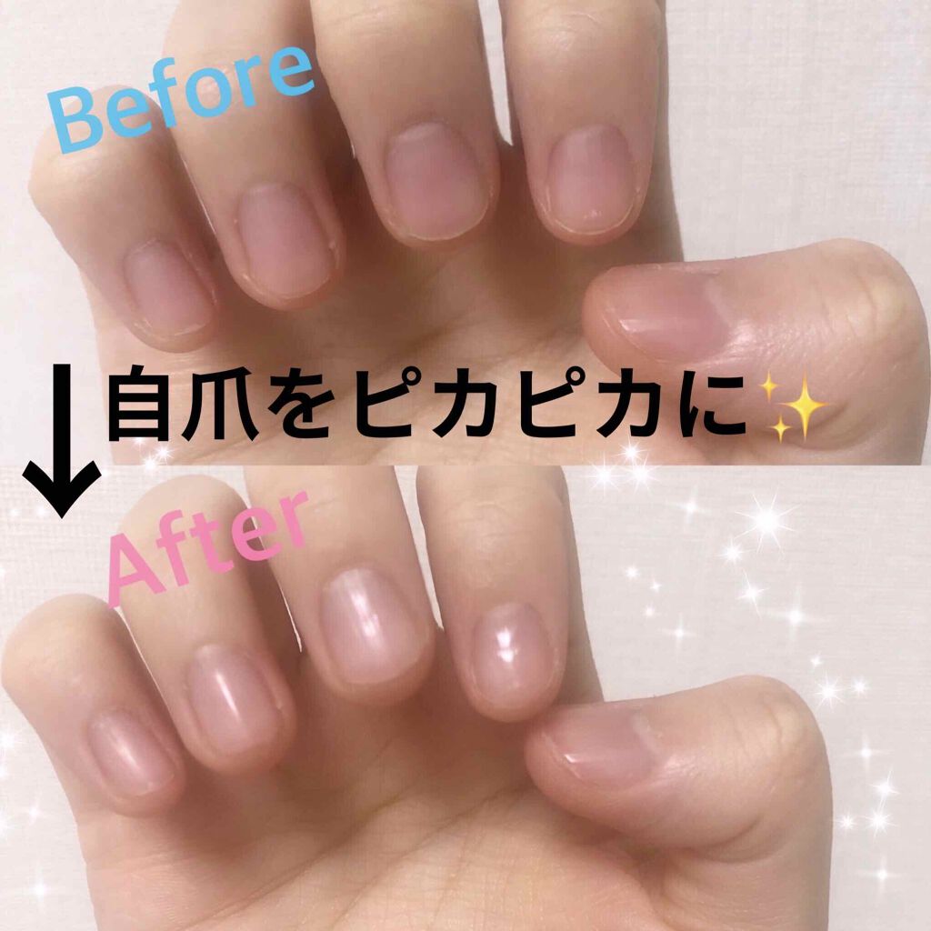 爪ミガキセット/デュカート/ネイル用品を使ったクチコミ(1枚目)