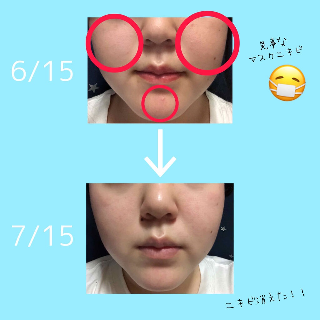 グリーンタンジェリン ビタCダークスポットケアパッド/goodal/トナーパッドを使ったクチコミ（2枚目）