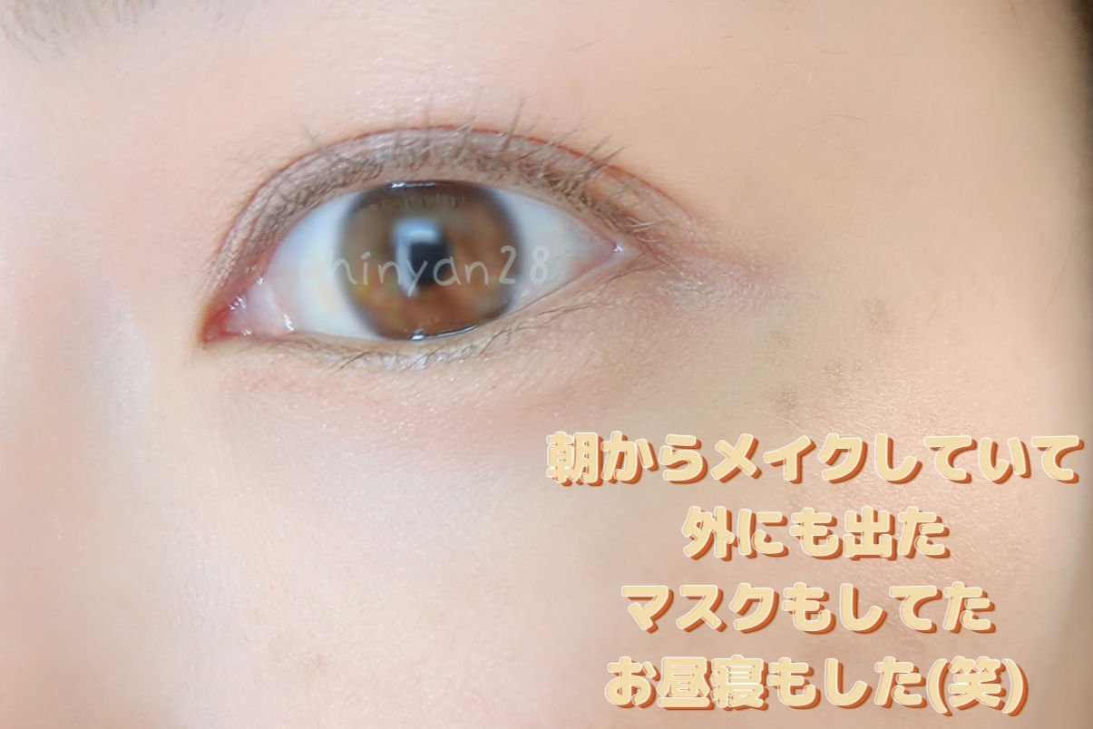 バイオイル/バイオイル/フェイスオイルを使ったクチコミ（2枚目）