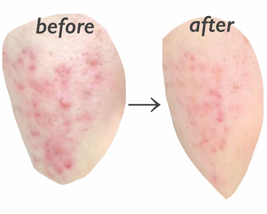 を使ったクチコミ（3枚目）