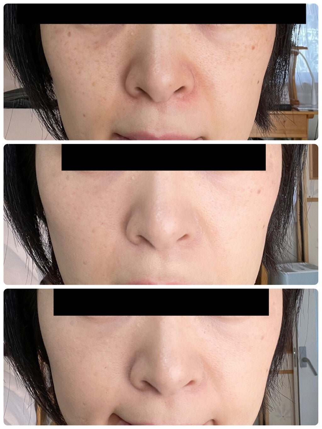 【旧】ディオールスキン フォーエヴァー スキン コレクト コンシーラー/Dior/リキッドコンシーラーを使ったクチコミ(3枚目)