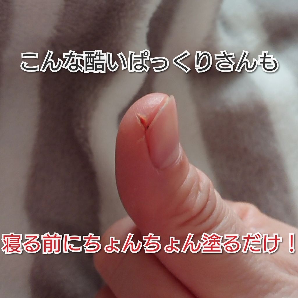 オリジナル ピュアスキンジェリー/ヴァセリン/ボディクリームを使ったクチコミ(2枚目)