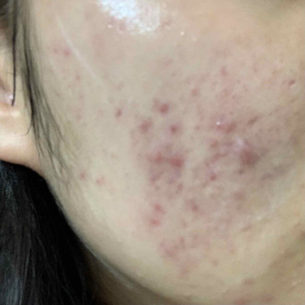 を使ったクチコミ（1枚目）