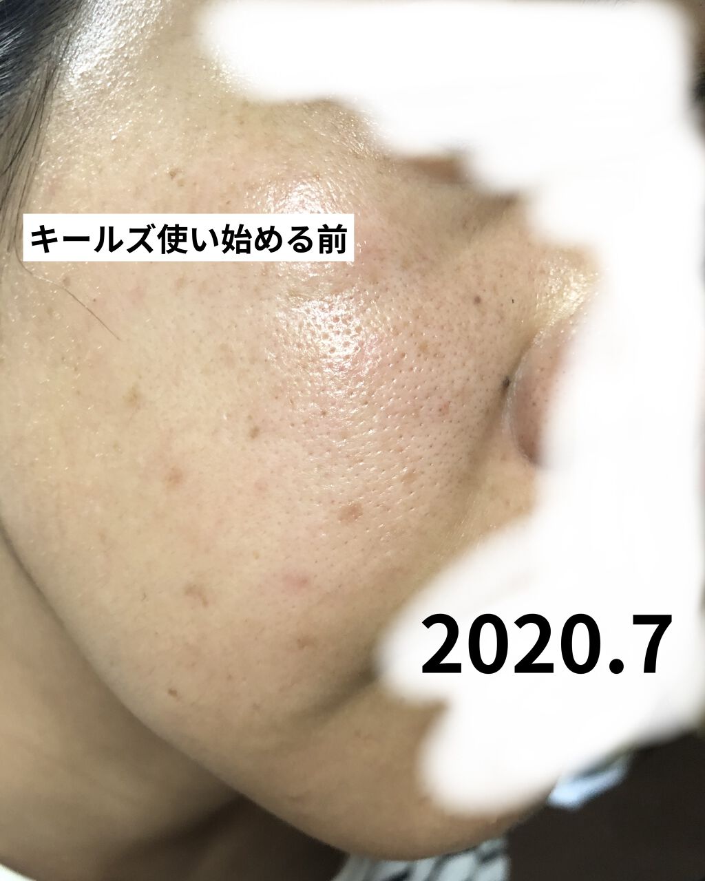 キールズ DS クリアリーブライト エッセンス[医薬部外品]/Kiehl's/美容液を使ったクチコミ（2枚目）