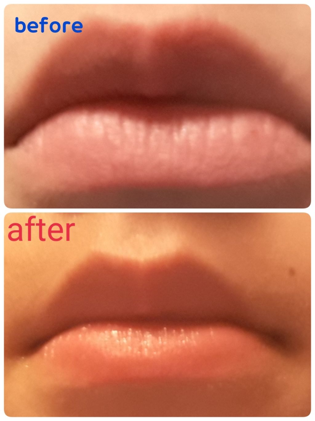 プルプルリップ/ピュレア/リップスクラブを使ったクチコミ(2枚目)