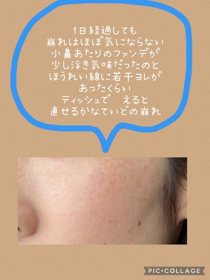 ディオールスキン フォーエヴァー フルイド グロウ/Dior/リキッドファンデーションを使ったクチコミ(4枚目)