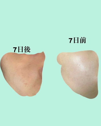 ãžã§ããã£ã㯠ã¢ããã³ã¹ã N/LANCOME/çŸå®¹æ¶²ã䜿ã£ãã¯ãã³ãïŒ2æç®ïŒ