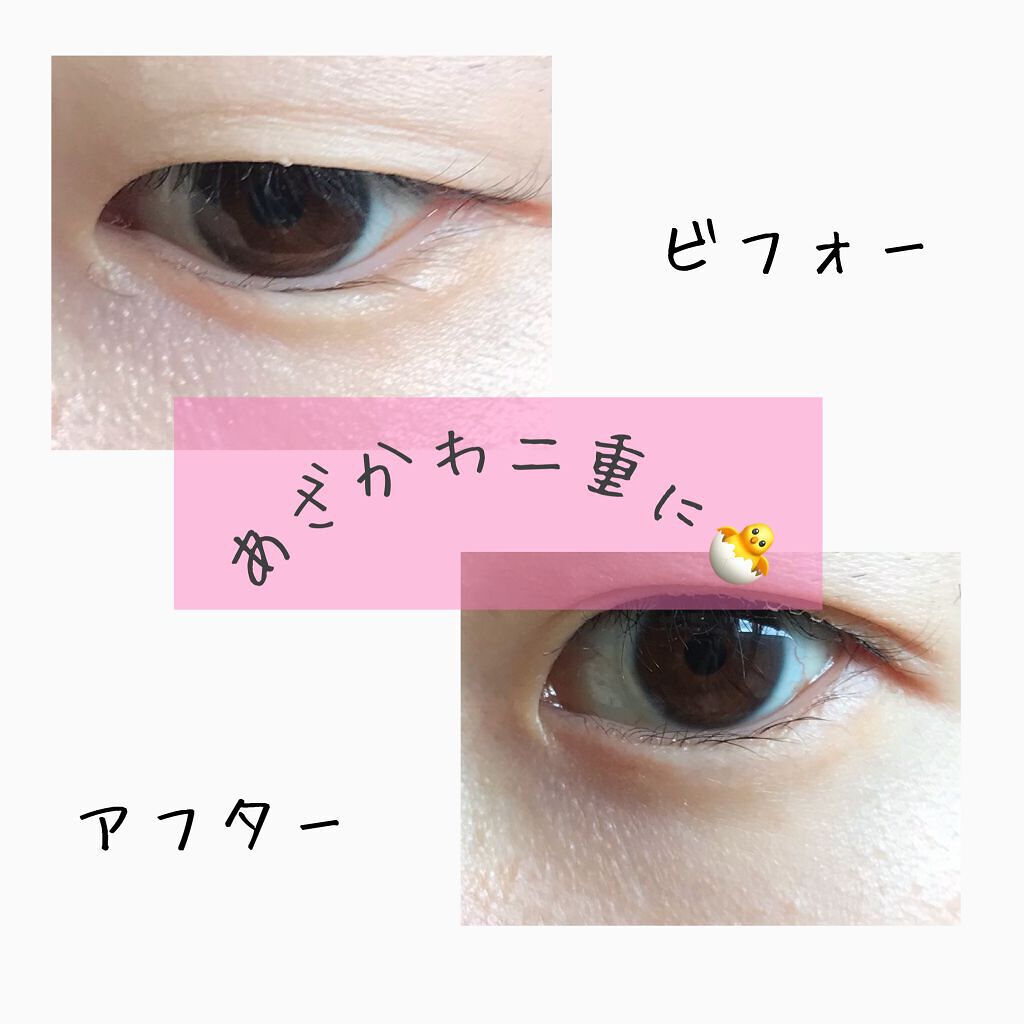 ふたえメッシュテープ/Eye Catching  Beauty/二重まぶた用アイテムを使ったクチコミ（1枚目）