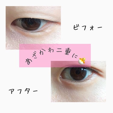 ふたえメッシュテープ/Eye Catching  Beauty/二重まぶた用アイテムを使ったクチコミ（1枚目）