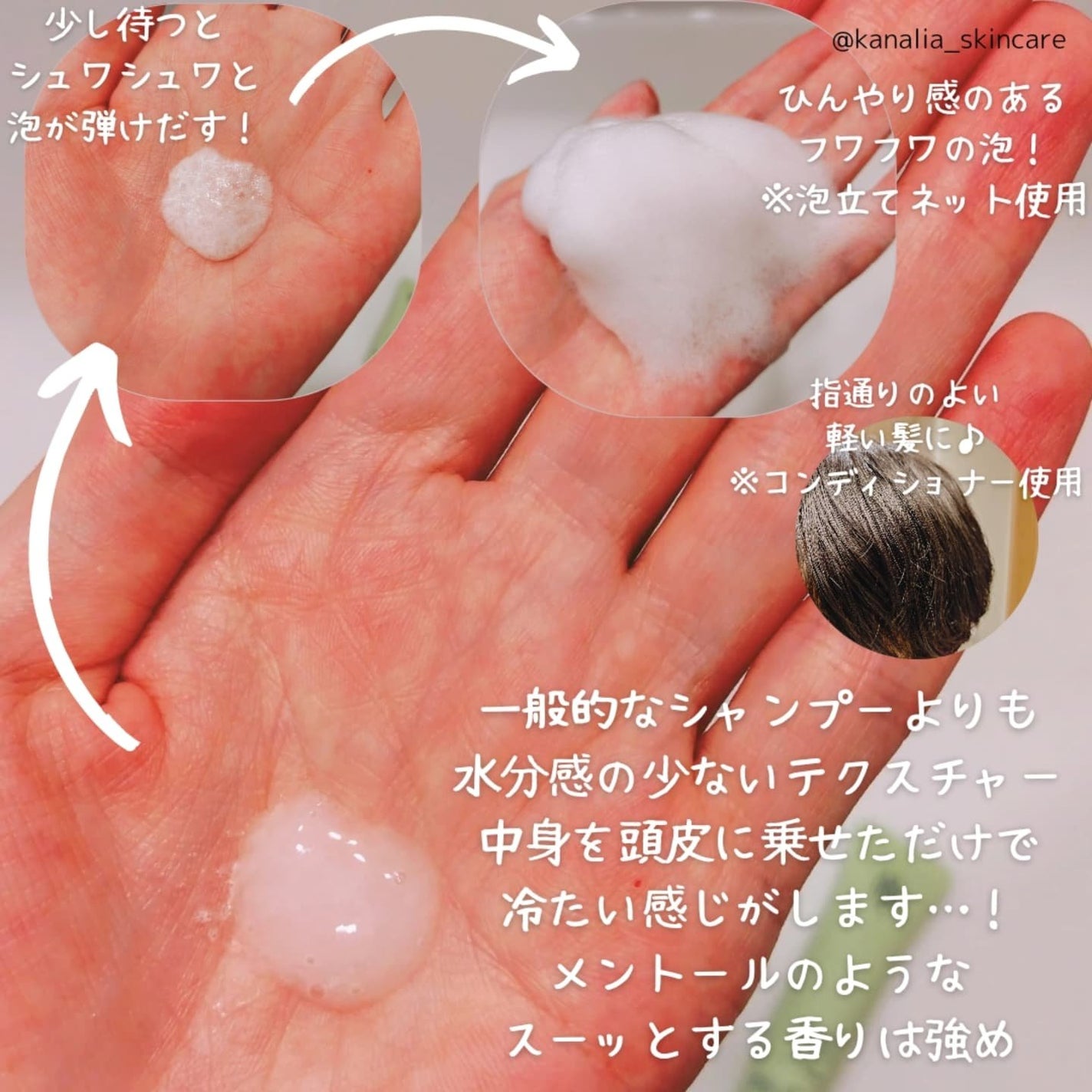 スパークリングスカルプスケーラー/ミンツリー/頭皮ケアを使ったクチコミ(2枚目)