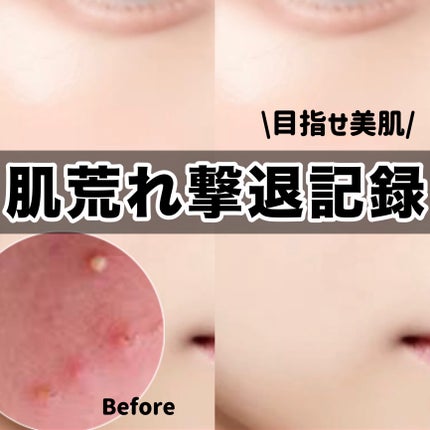 マイルドクレンジング オイル/ファンケル/オイルクレンジングを使ったクチコミ(1枚目)