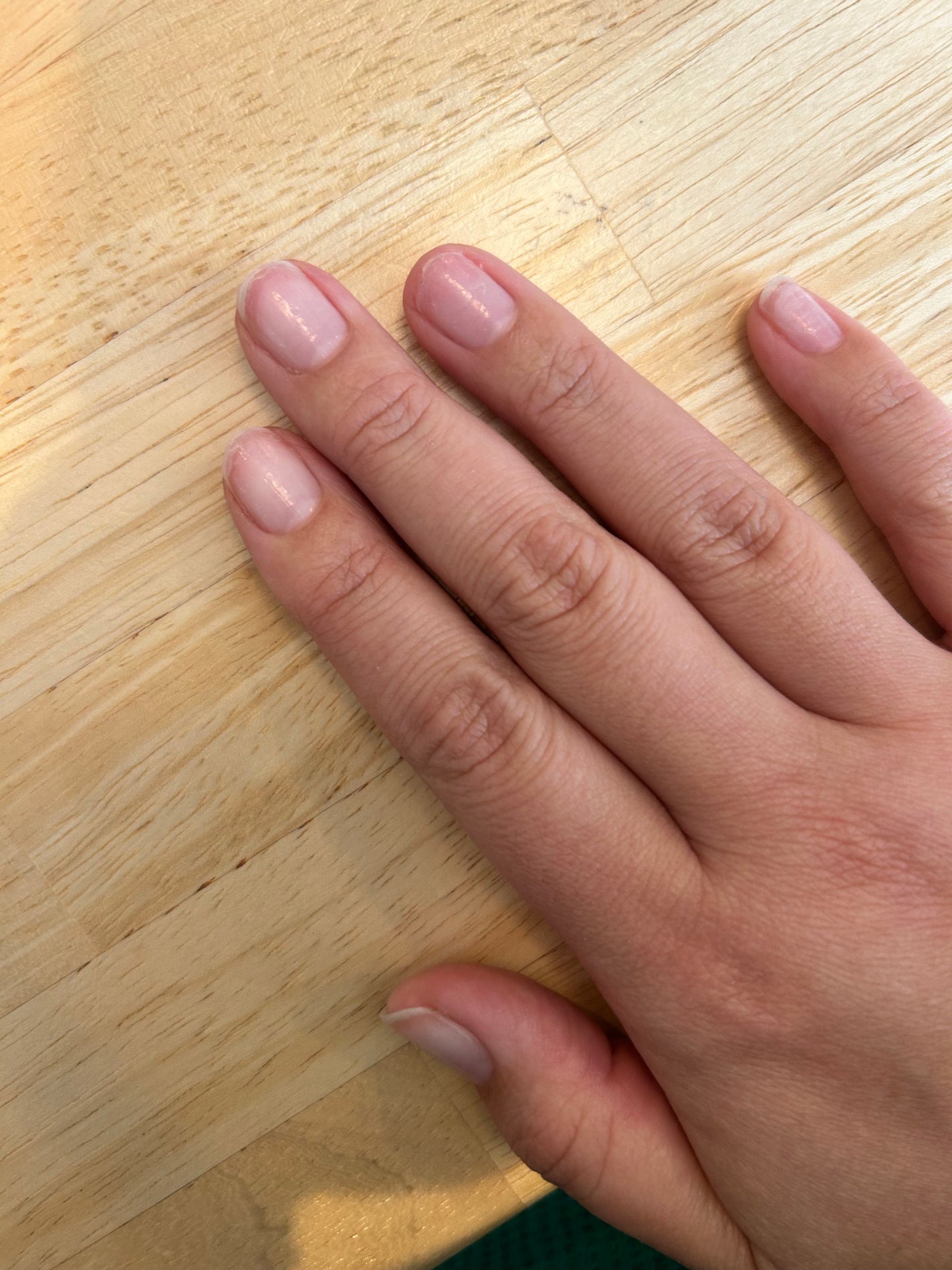 ちよこ on LIPS 「爪育する事にしました💅🙅🏻♀️記録出来たらしていこうかと思っ..」(1枚目)