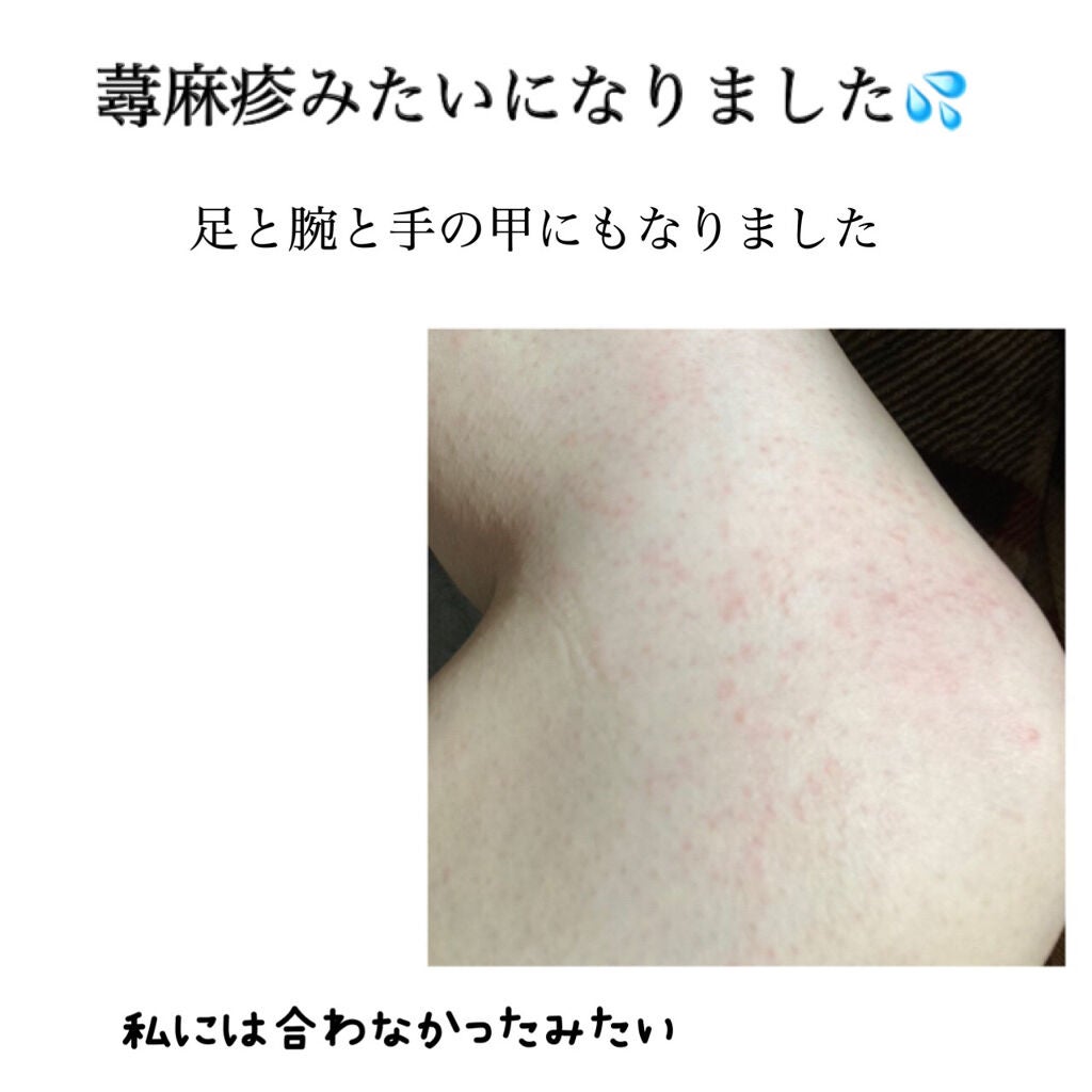 ヒルマイルドクリーム(医薬品)/健栄製薬/その他を使ったクチコミ(3枚目)