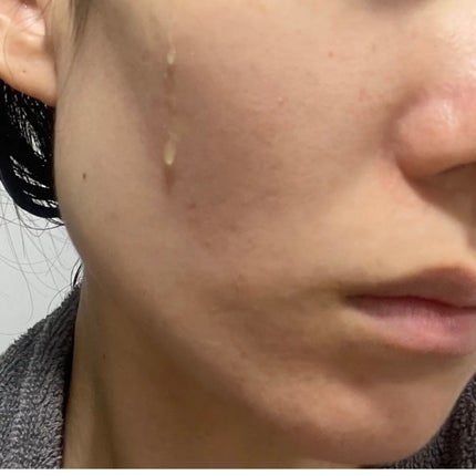 グルタ ビタミンC トーニング アンプル/IOPE/美容液を使ったクチコミ(2枚目)