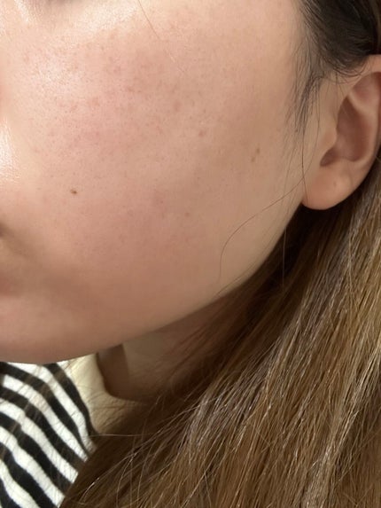 エッセンス ミルキークリーム (しっとり)/アルージェ/フェイスクリームを使ったクチコミ(4枚目)