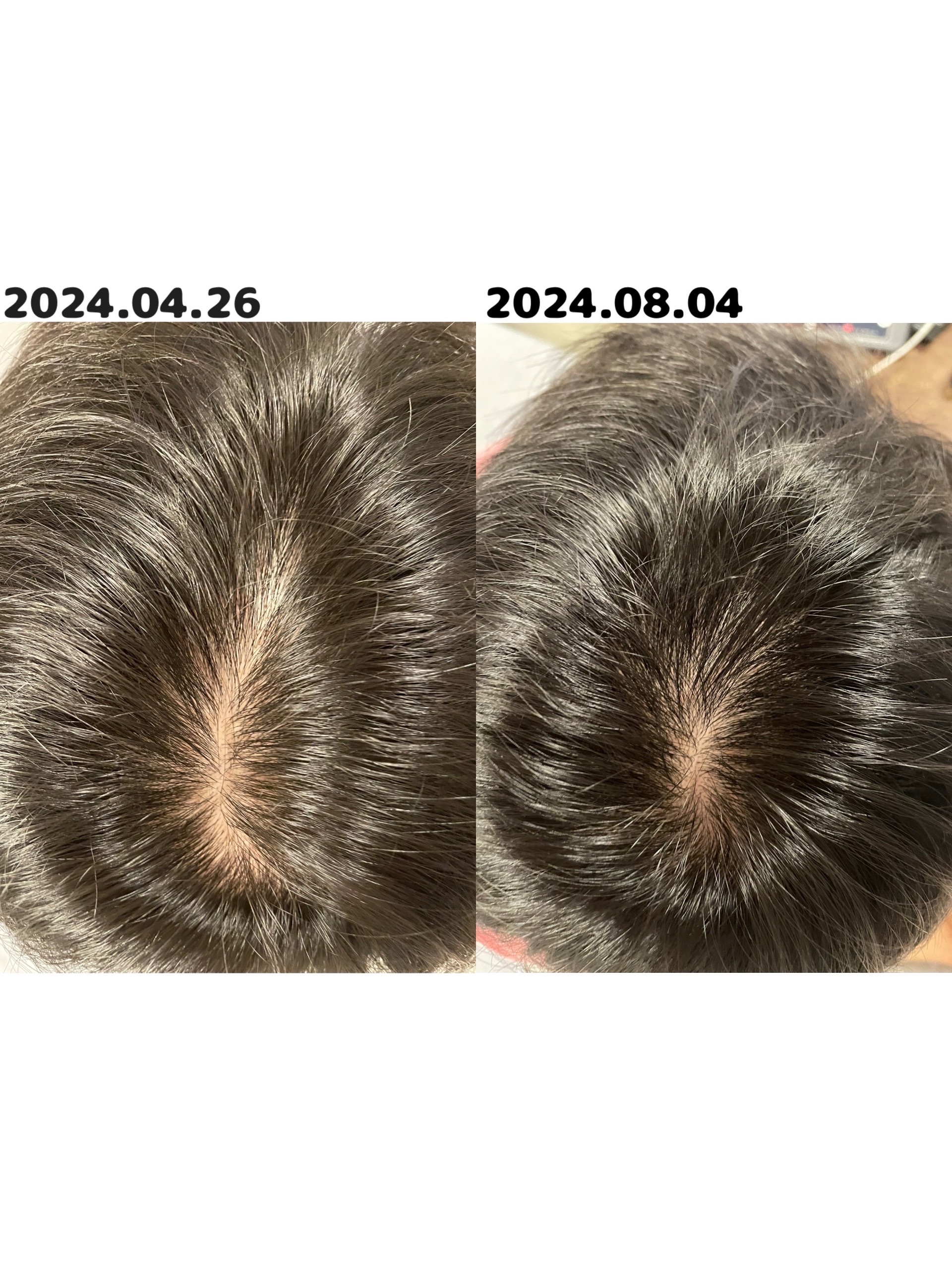 SonoRepro/アンファー(スカルプD)/ヘアケアグッズを使ったクチコミ（3枚目）