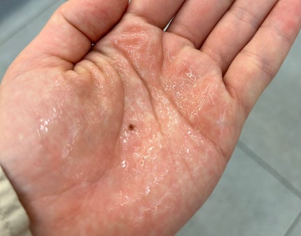 グルタ ビタミンC トーニング アンプル/IOPE/美容液を使ったクチコミ(3枚目)