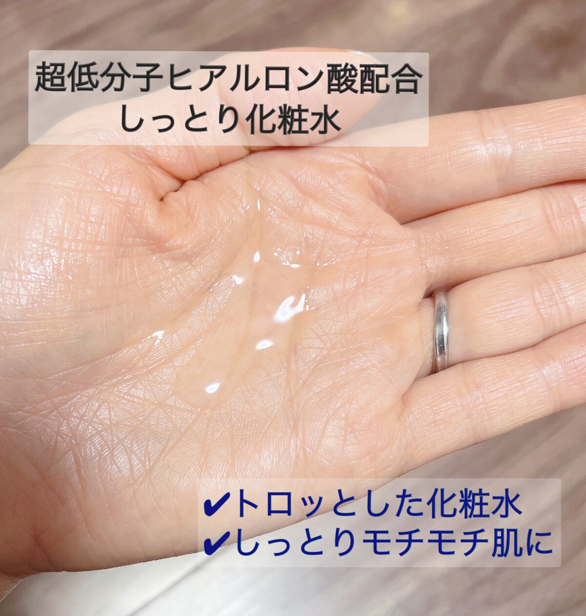 エッセンシャル トリートメントローション/ロベクチン/化粧水を使ったクチコミ（2枚目）