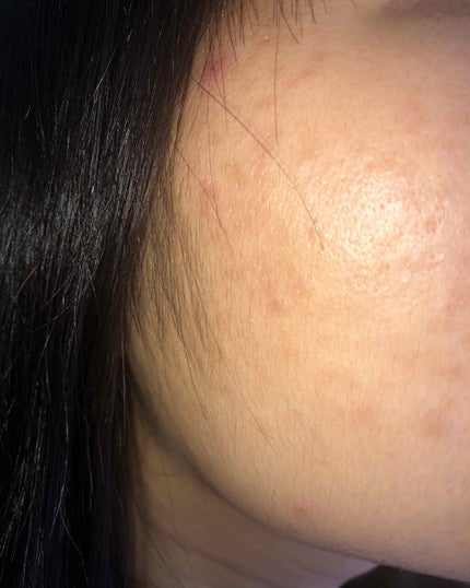 ハトムギ化粧水(ナチュリエ スキンコンディショナー R )/ナチュリエ/化粧水を使ったクチコミ(3枚目)